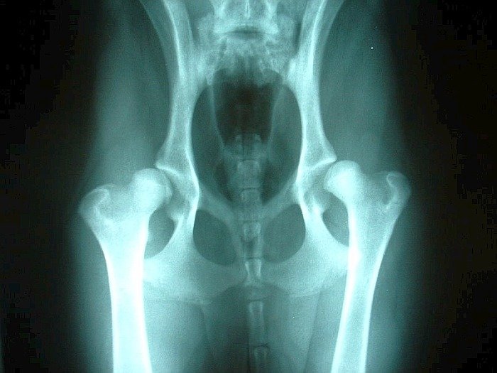 Bilateral hip dysplasia in dogs Bilateral hip dysplasia in dogs