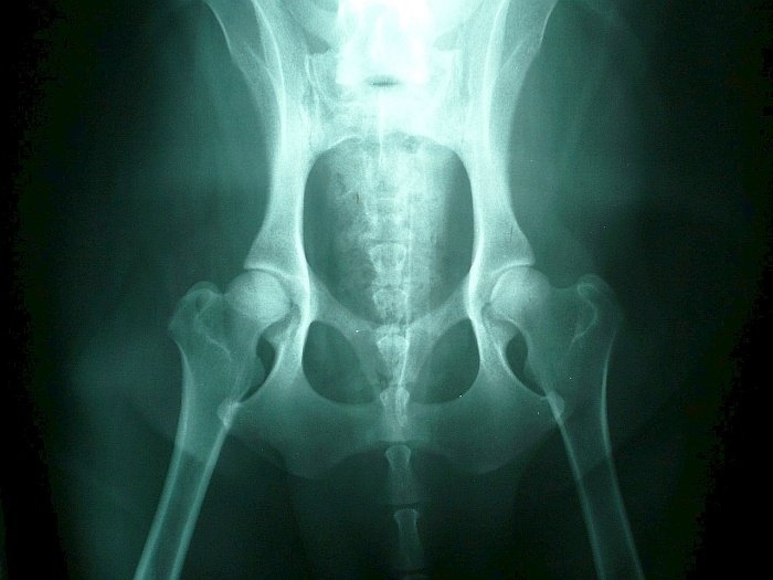 normal dog hips Normal dog hips